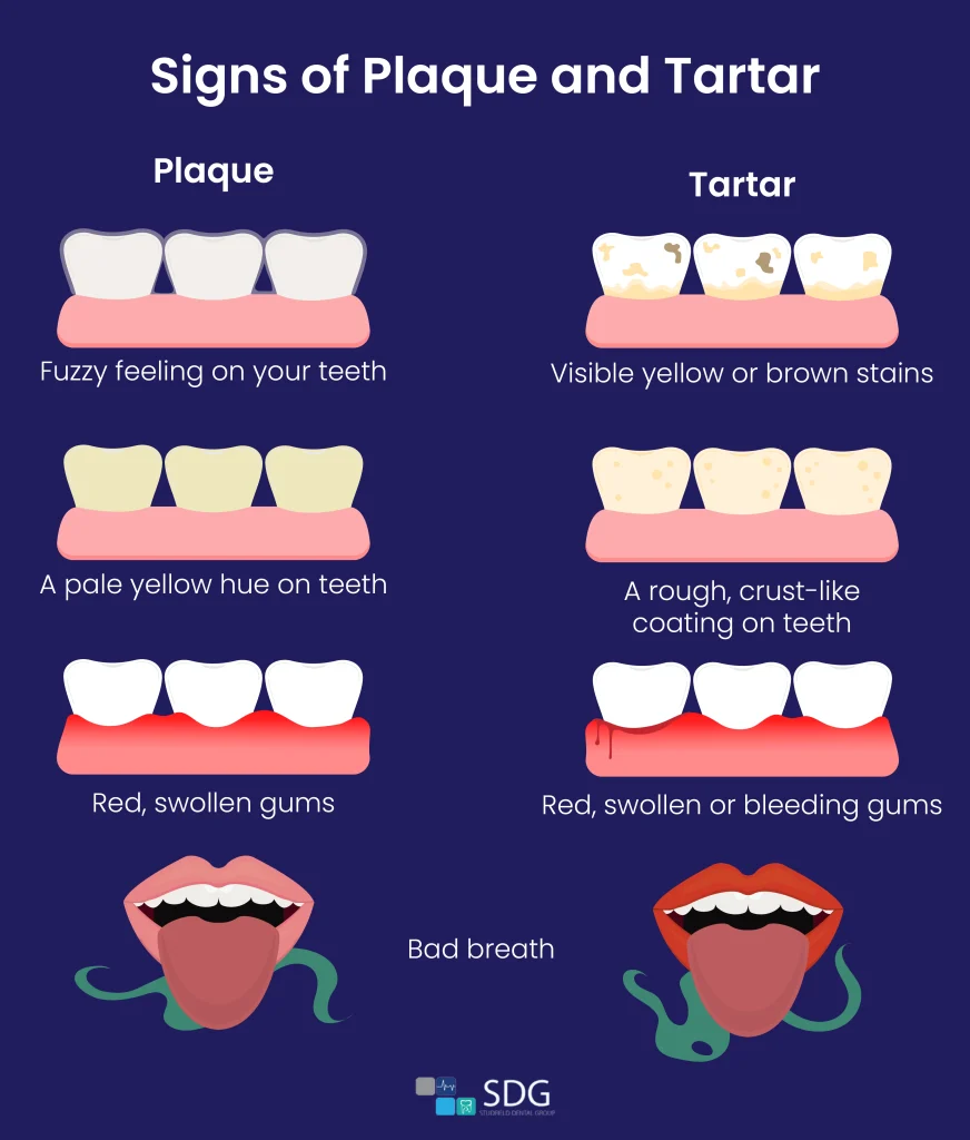 Signs of plaque and tartar 