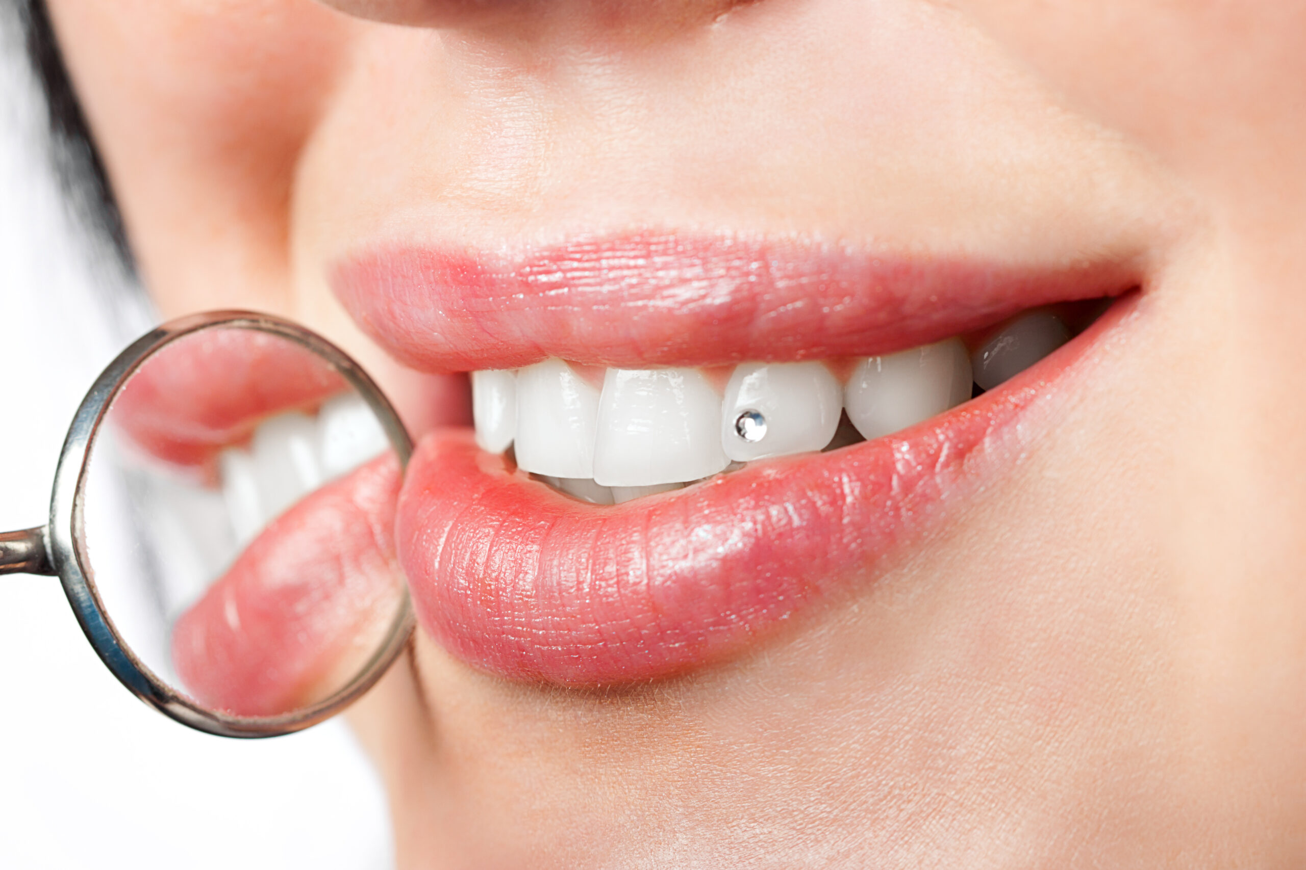 tooth gems
